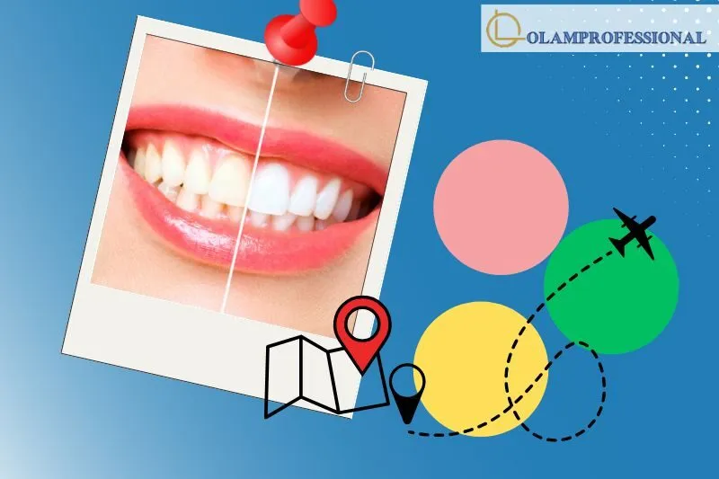 Top 6 Địa Điểm Tẩy trắng răng Hà Tĩnh Chất Lượng