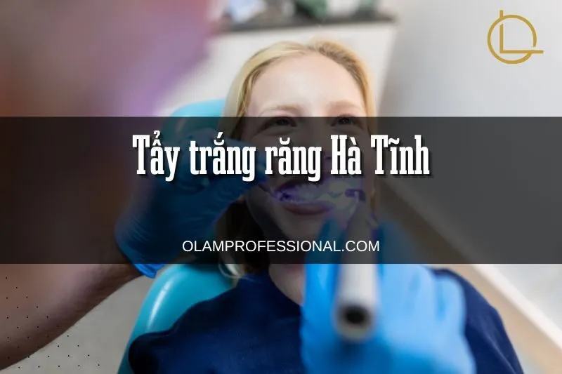 Tẩy trắng răng Hà Tĩnh: Top phòng khám uy tín và chất lượng